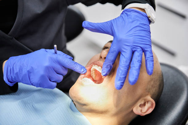 Best Broken or Chipped Tooth Repair in Oakhurst, CA